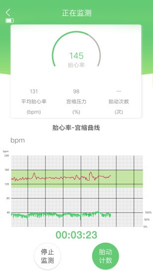 喜芽胎心监护仪软件(2)