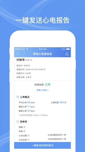 卡帕奇心電(3)