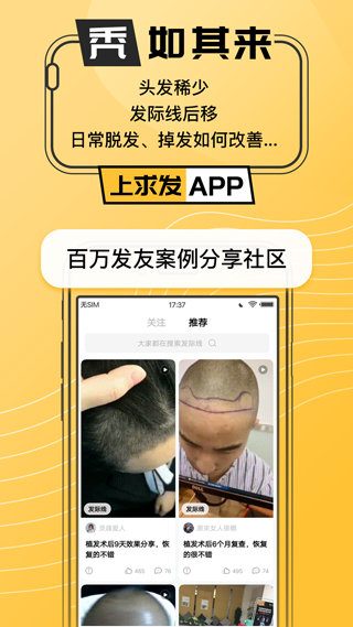 求發(1)