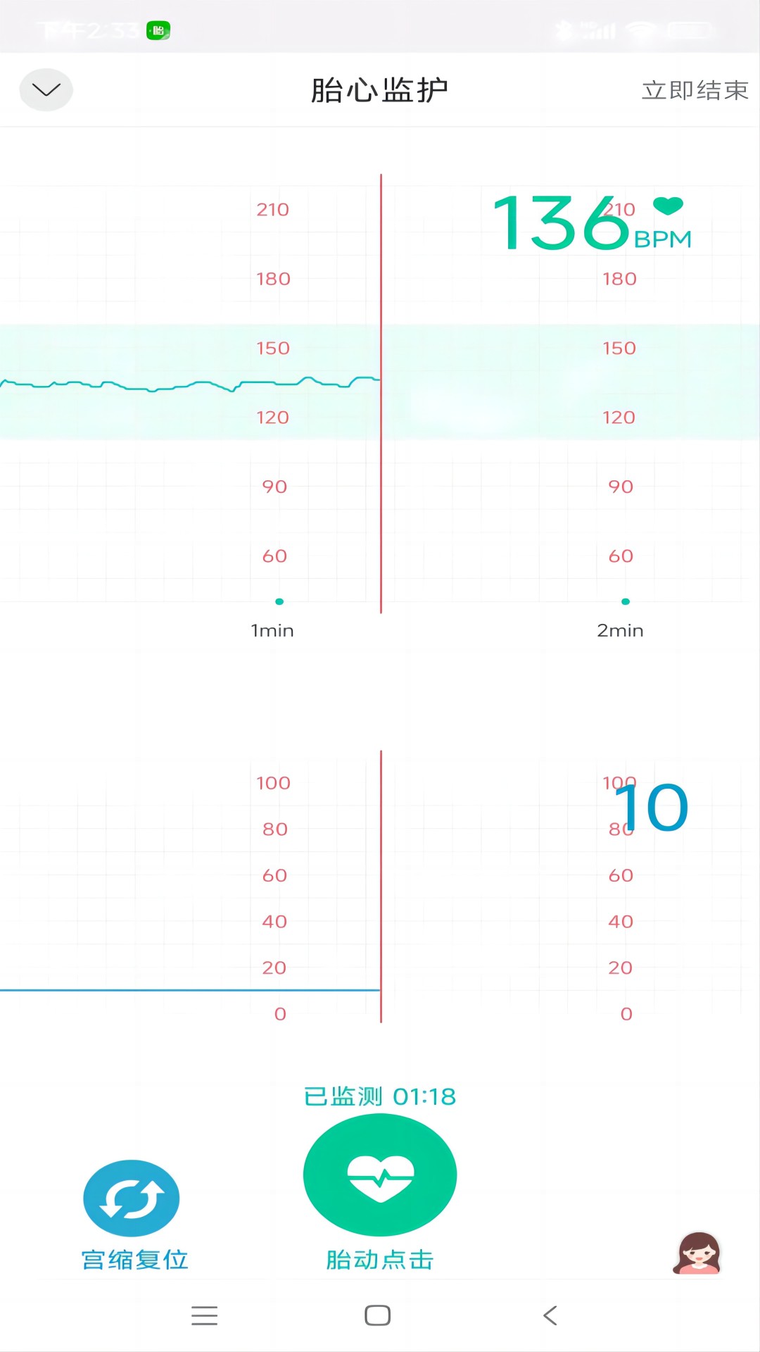 微胎心用户版(3)